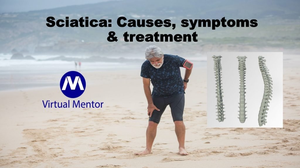 Sciatic-Nerve-Sciatica-Pain-Sciatica-treatment-at-Home